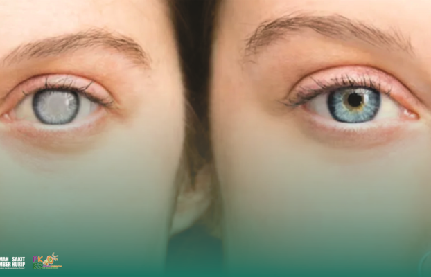 Mengenal Glaukoma sebagai Penyebab Kebutaan Permanen dan Cara Mencegahnya